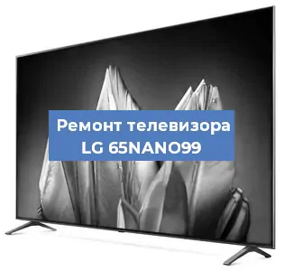 Замена динамиков на телевизоре LG 65NANO99 в Воронеже